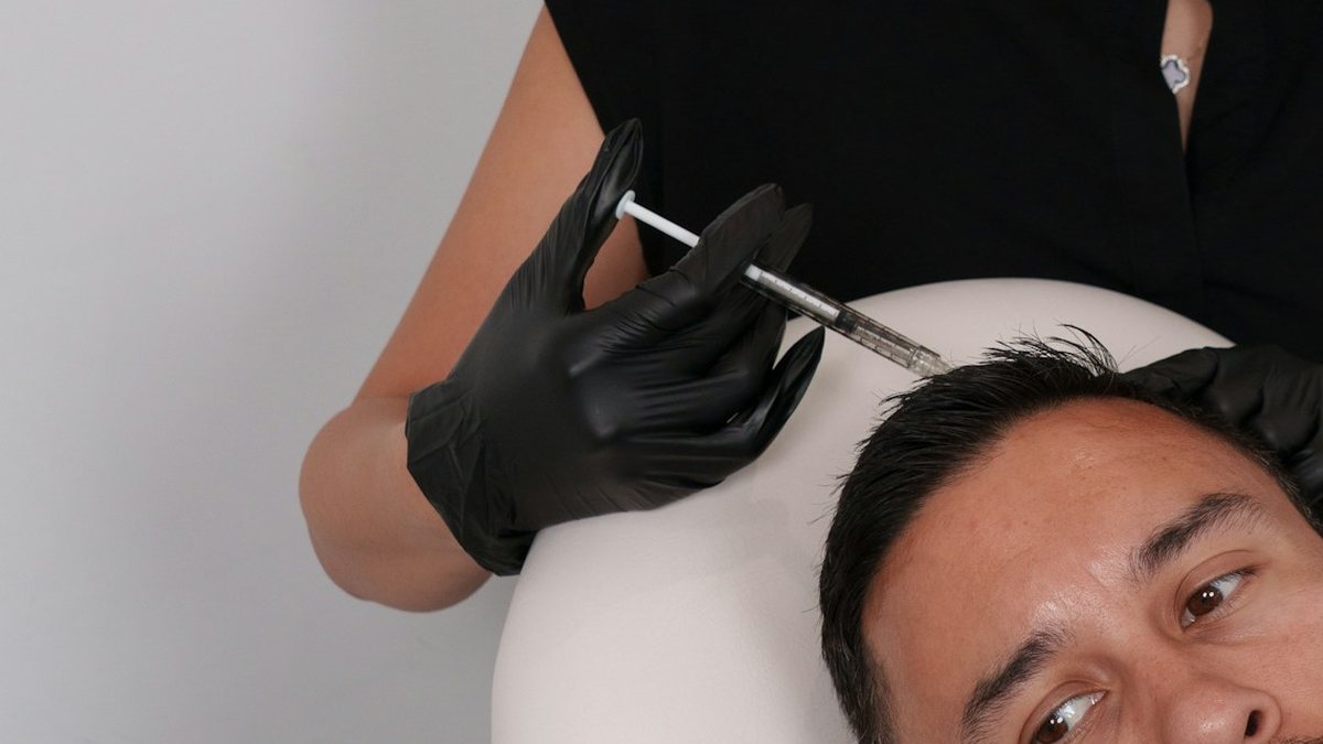 Tindakan pada kulit kepala pasien pria di klinik transplantasi rambut