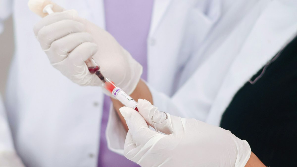 Petugas klinik menyiapkan sampel darah untuk perawatan PRP rambut
