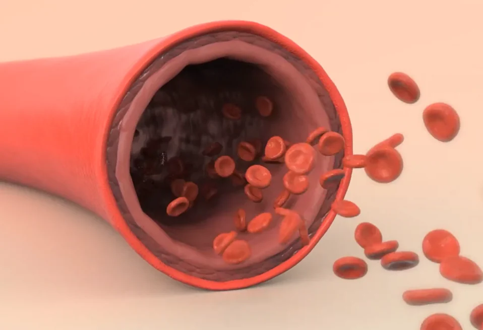 Penile blood flow after