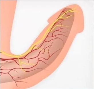 Viagra treatment