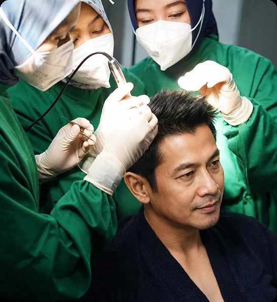 Prosedur hair transplant di The Men's Clinic