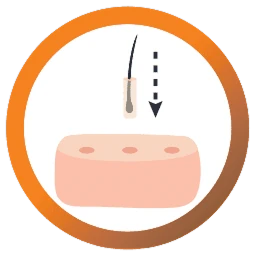 Implantasi folikel