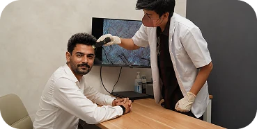 Konsultasi hair transplant
