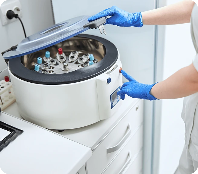 Proses centrifuge PRP di laboratorium