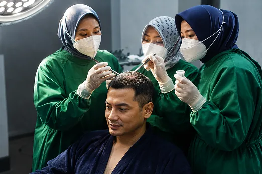 Prosedur hair transplant — The Men's Clinic