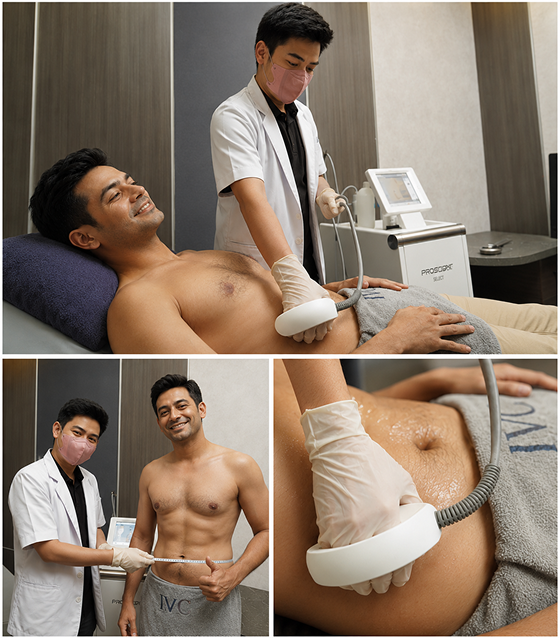 Venus Freeze RF treatment - Prostork