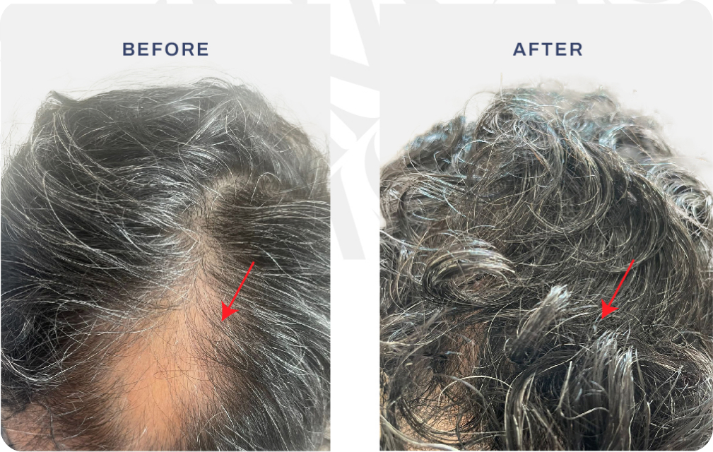 Before after pasien Singapore
