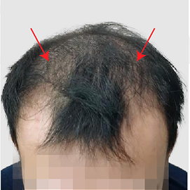 Pasien Medical PRP sebelum perawatan